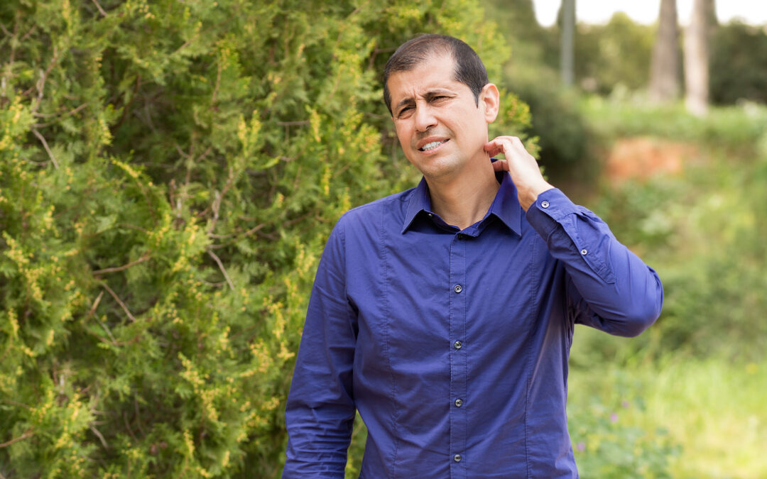 How to Protect Your Skin From Plant Related Rashes