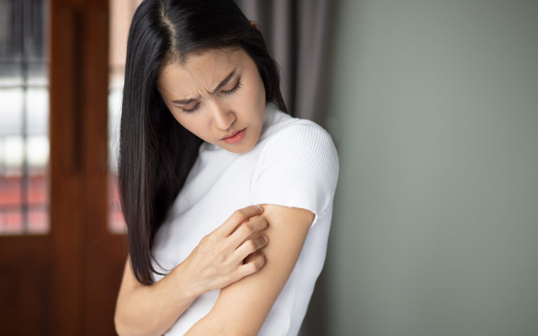 Dry Skin Explained by AFC Hickory